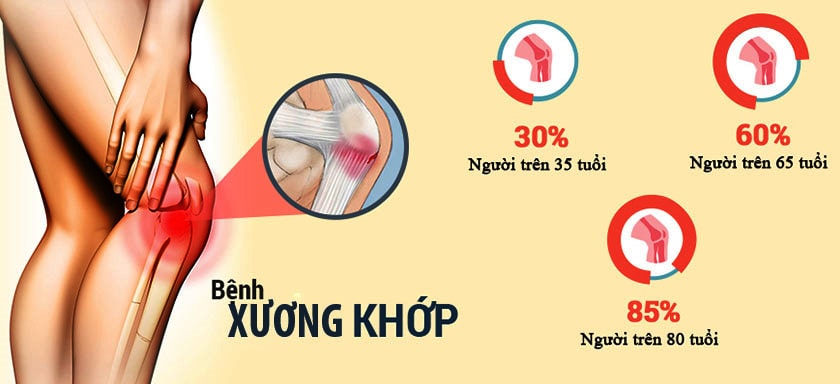 thuoc tri dau lung moi goi cua nhat thuốc trị đau lưng mỏi gối của nhật