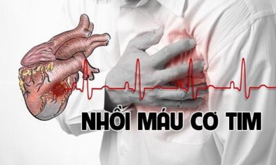 dong trung ha thao dieu tri benh nhoi mau co tim
