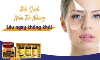dieu tri nam tan nhang
