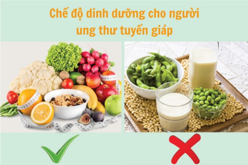 che-do-dinh-duong-cho-nguoi-benh-ung-thu-tuyen-giap Chế độ dinh dưỡng cho người bệnh ung thu tuyen giáp