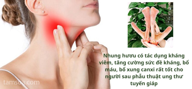 tac dung cua nhung huou voi nguoi bi ung thu tuyen giap Tác dụng của nhung hươu với người bị ung thư tuyến giáp