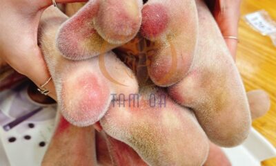 Nhung hươu kỵ gì và lưu ý khi sử dụng