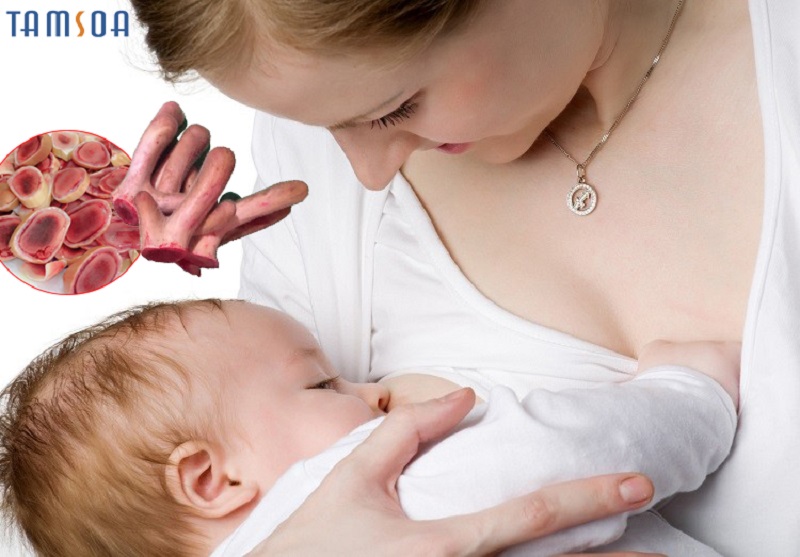 Nhung hươu với phụ nữ sau khi sinh