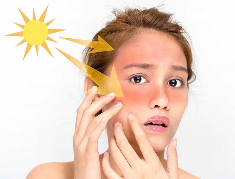 Tác động từ tia UV là nguyên nhân dẫn đến lão hóa da