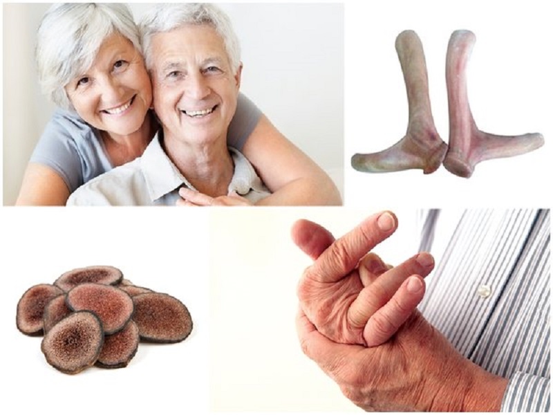 Nhung hươu hỗ trợ điều trị xương khớp, gout