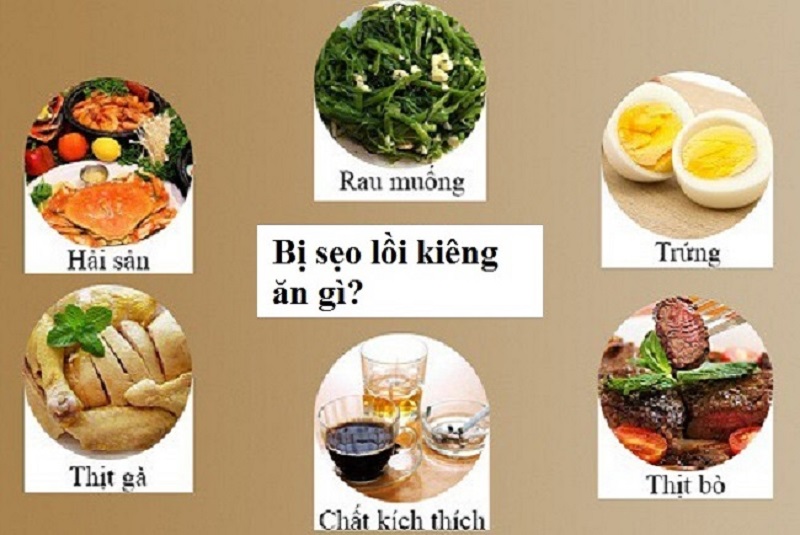 Nên kiêng rau muống, xôi nếp, da gà… để không bị dị ứng, sẹo lồi