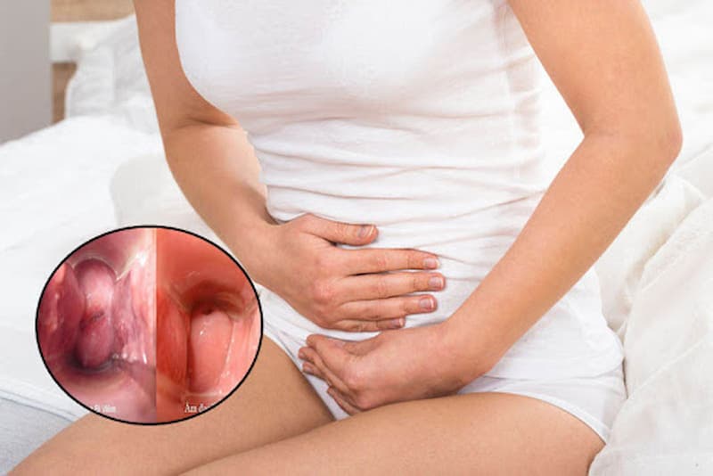Phụ nữ sau sinh thường bị đau nhức ở âm đạo vì sinh con qua đường này