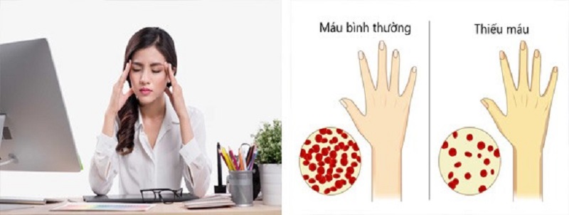 Nguyên nhân gây thiếu máu