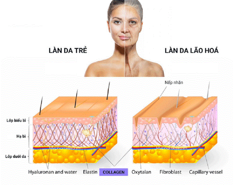 Kết cấu collagen và elastin lỏng lẻo hơn là dấu hiệu da đang dần lão hóa