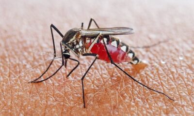 Sốt xuất huyết là bệnh truyền nhiễm cấp tính do virus Dengue gây ra