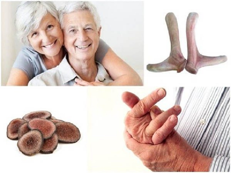 Nhung hươu giúp tăng tuần hoàn máu, giảm đau nhức xương ở người già