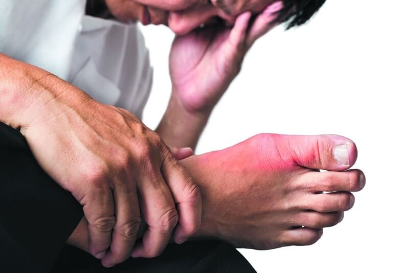 Bệnh gút thường xuất hiện ở nam giới độ tuổi trung niên