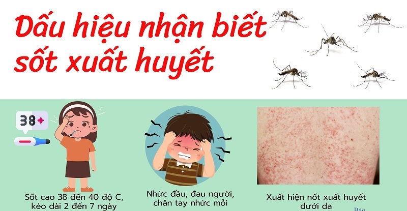 Dấu hiệu sốt xuất huyết