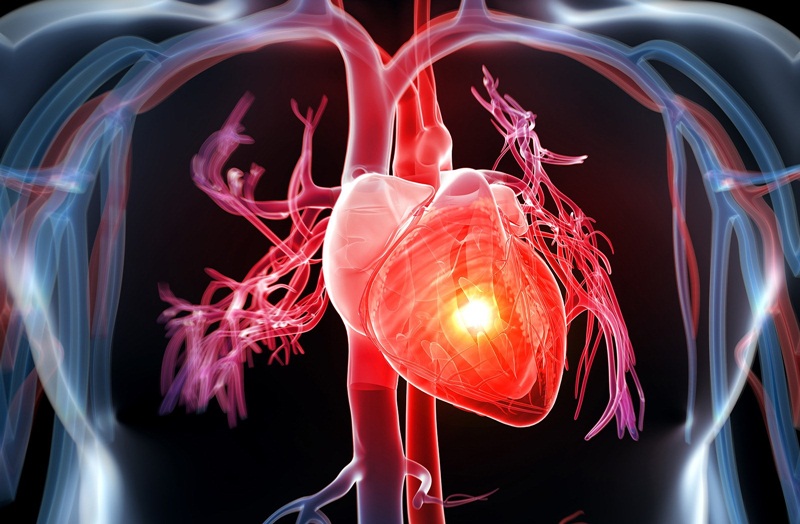 Điều trị bệnh tim mạch Điều trị bệnh tim mạch