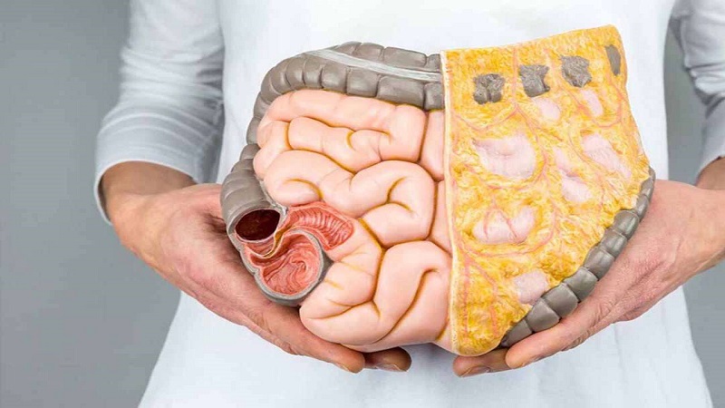 Cách phòng ngừa các bệnh về đường tiêu hóa Cách phòng ngừa các bệnh về đường tiêu hóa