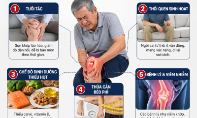 5 nguyên nhân khiến bạn bị đau khớp